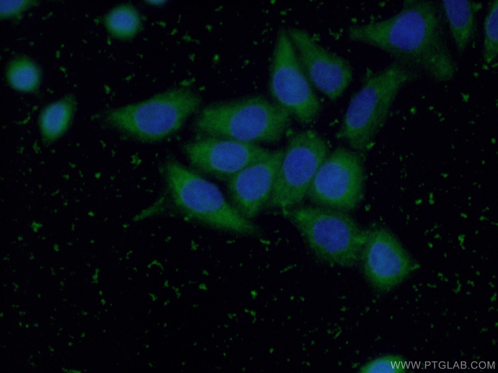 GGCT Polyclonal antibody