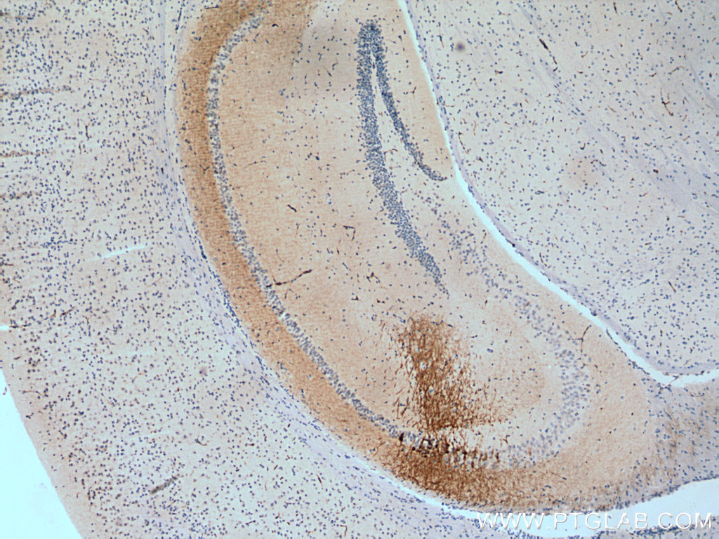 RGS14 Polyclonal antibody