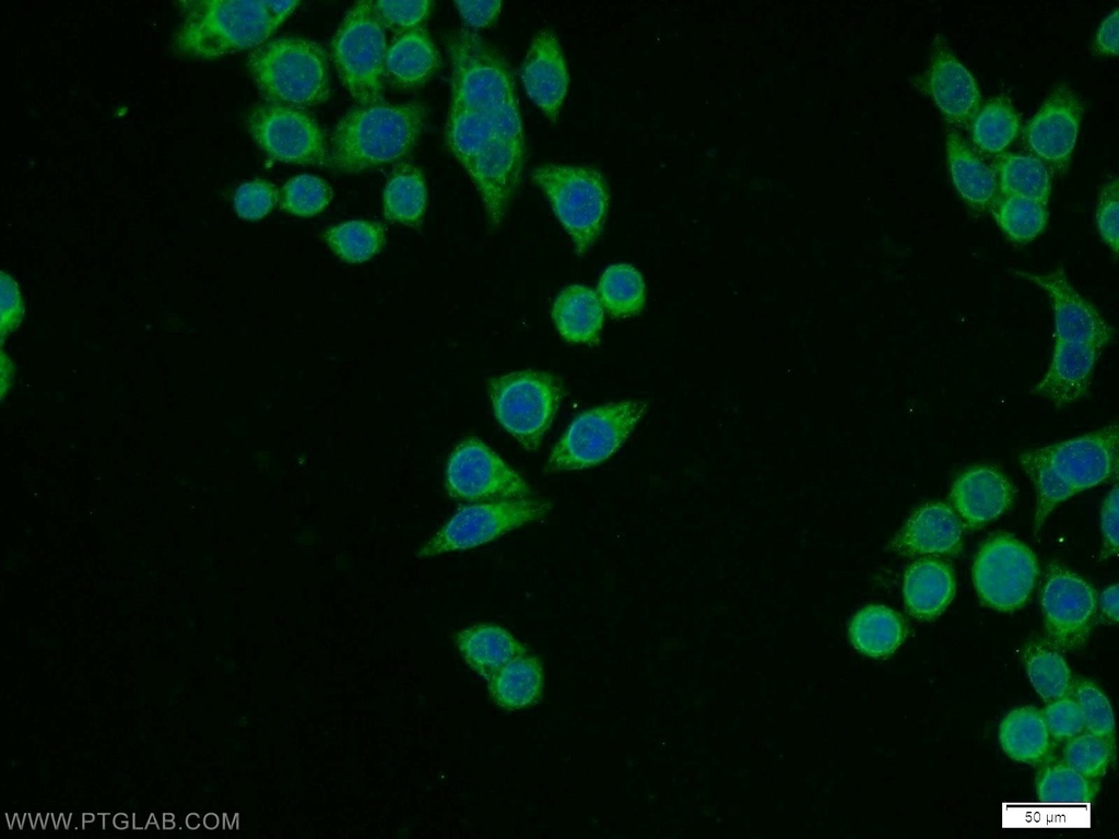 RPL11 Polyclonal antibody