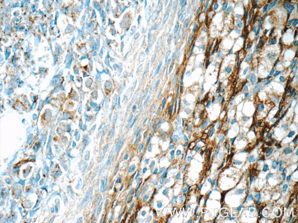 HSD17B11 Polyclonal antibody