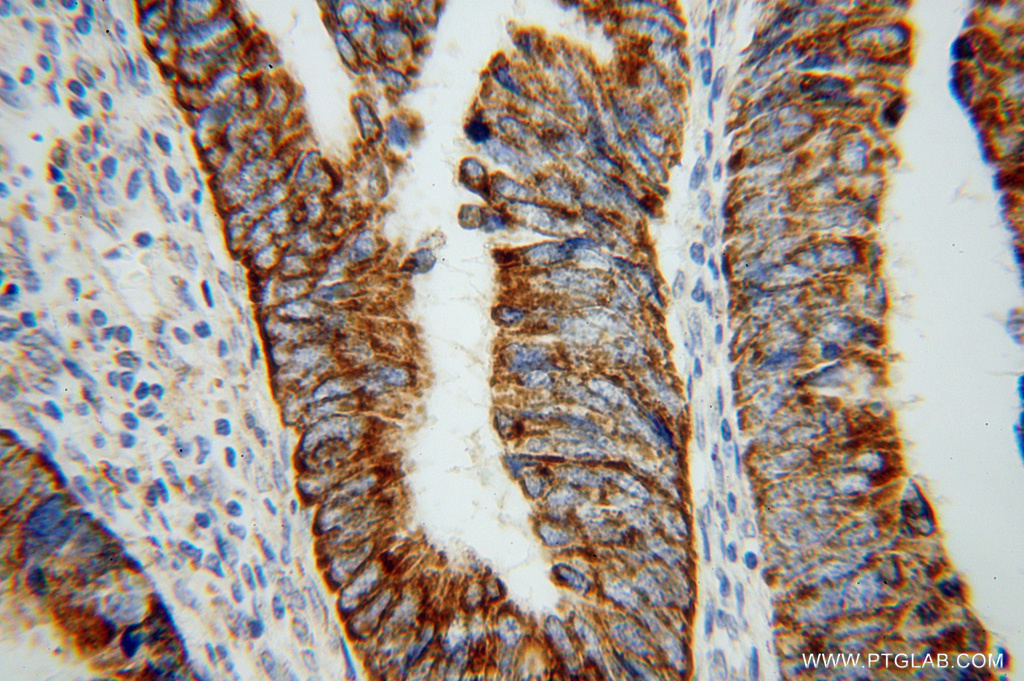 TST Polyclonal antibody