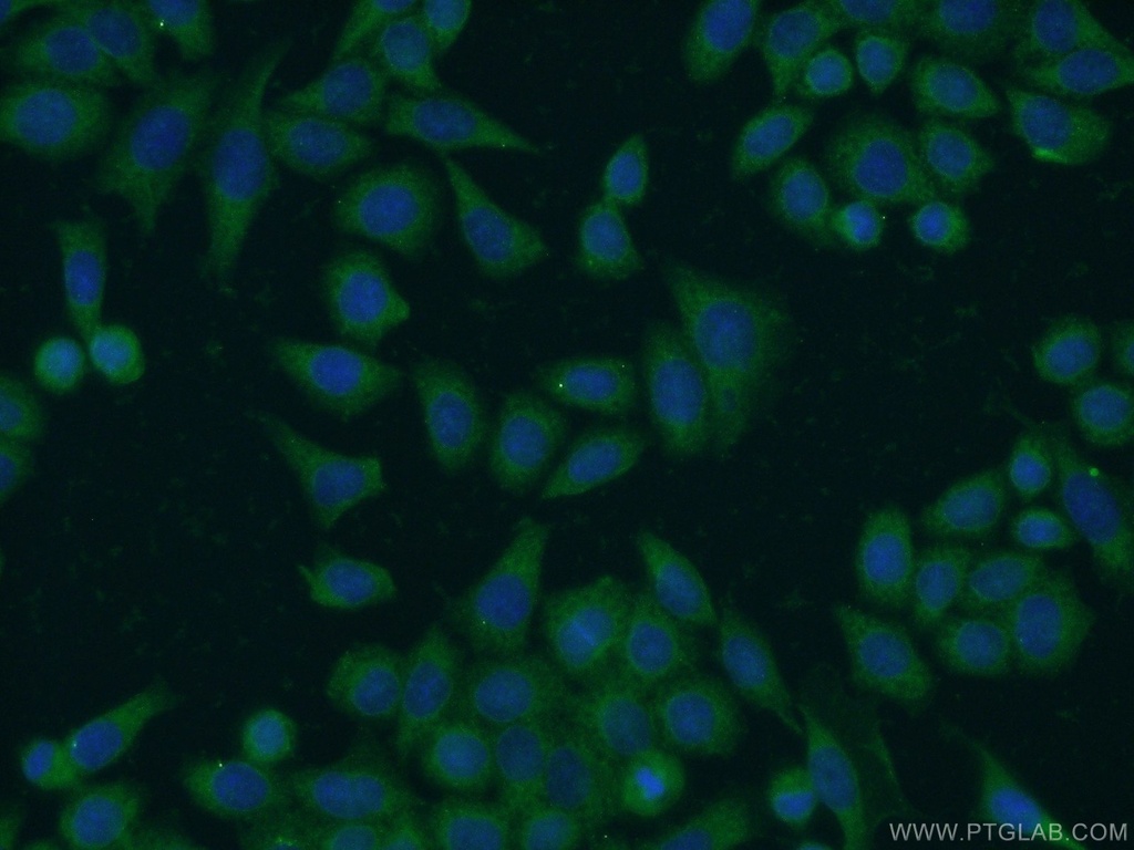 FN3KRP Polyclonal antibody
