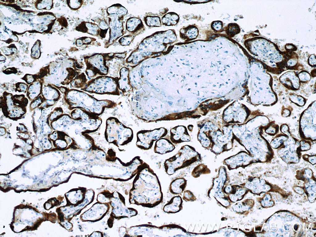 Placental lactogen Polyclonal antibody