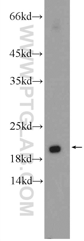 RAB30 Polyclonal antibody