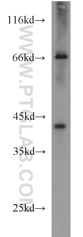 GFOD2 Polyclonal antibody
