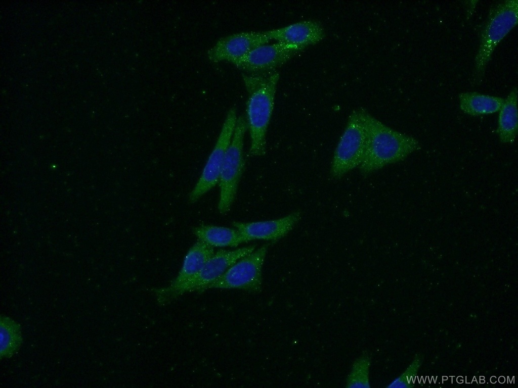 FARSB Polyclonal antibody