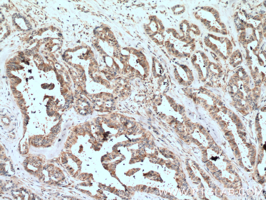 VAV1 Polyclonal antibody