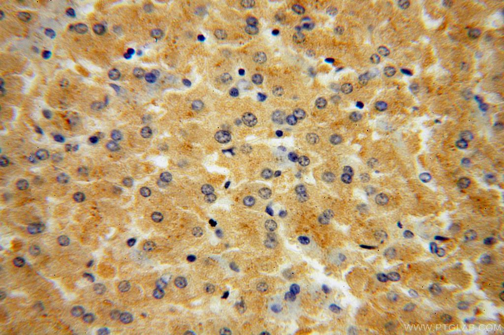 CSNK1G1 Polyclonal antibody