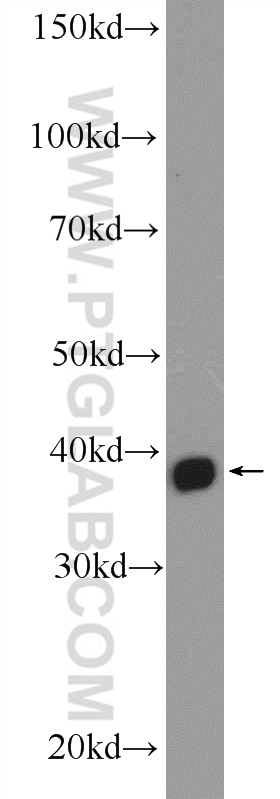 MRM1 Polyclonal antibody
