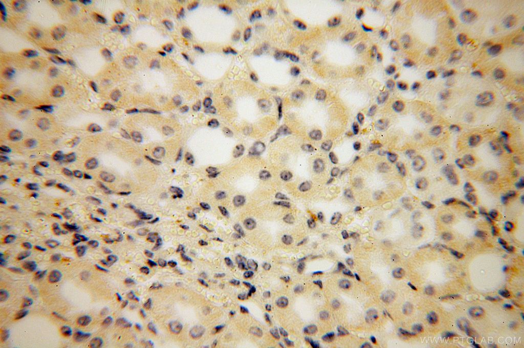 PISD Polyclonal antibody