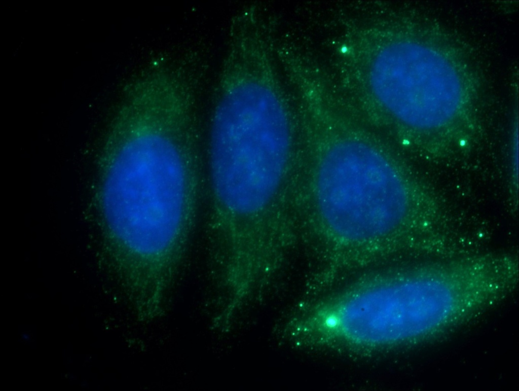 Antithrombin III Polyclonal antibody