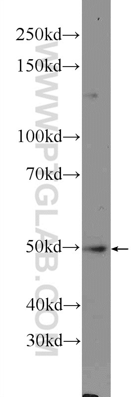 NLE1 Polyclonal antibody