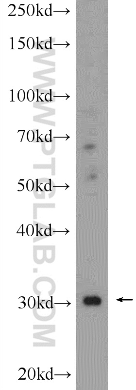 CHST8 Polyclonal antibody