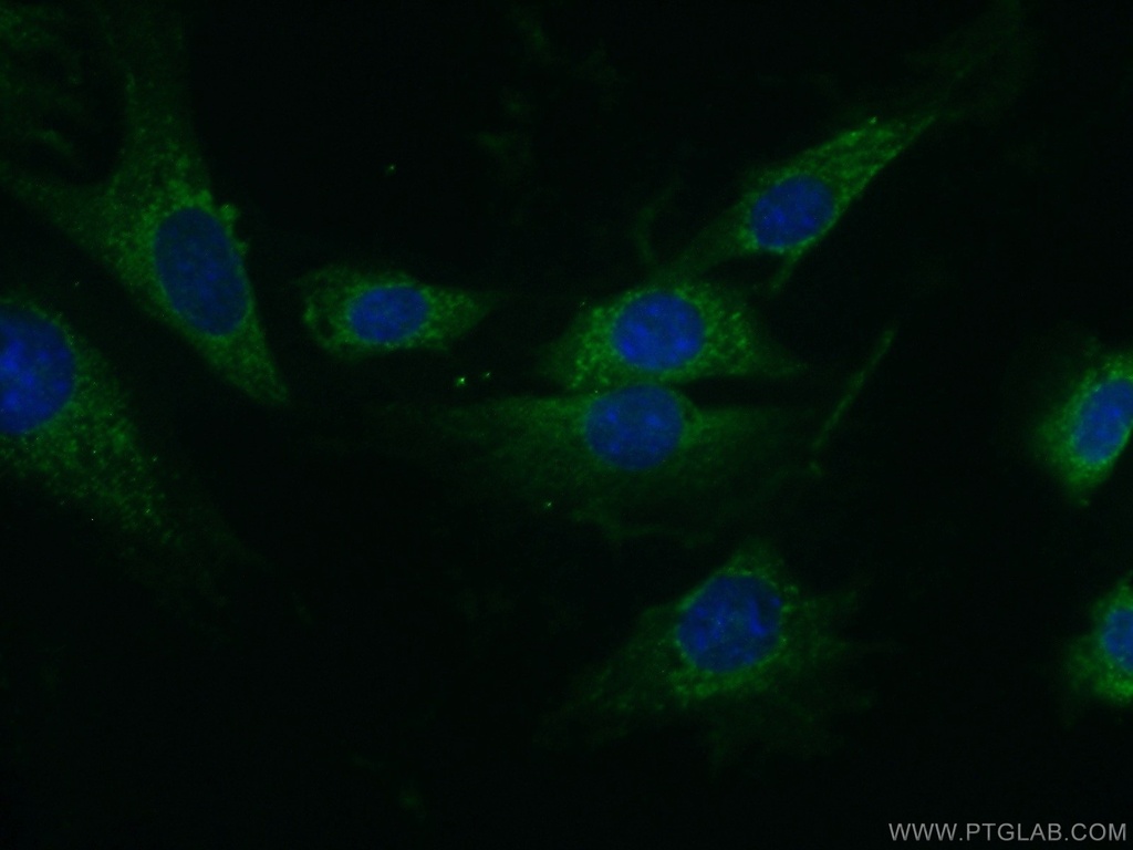 PAN2 Polyclonal antibody