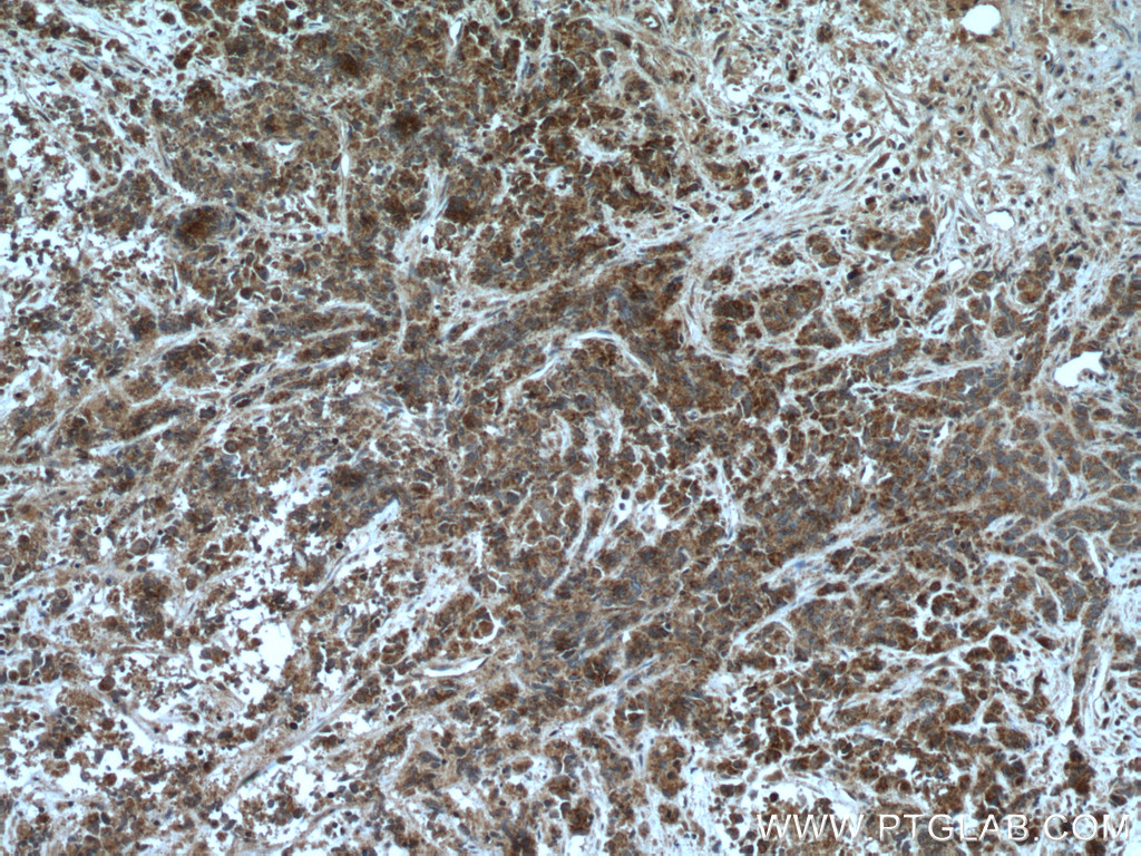 AGXT2L2 Polyclonal antibody