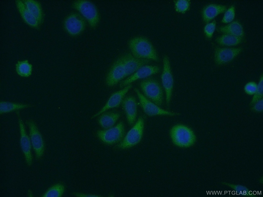 DNAJB5 Polyclonal antibody