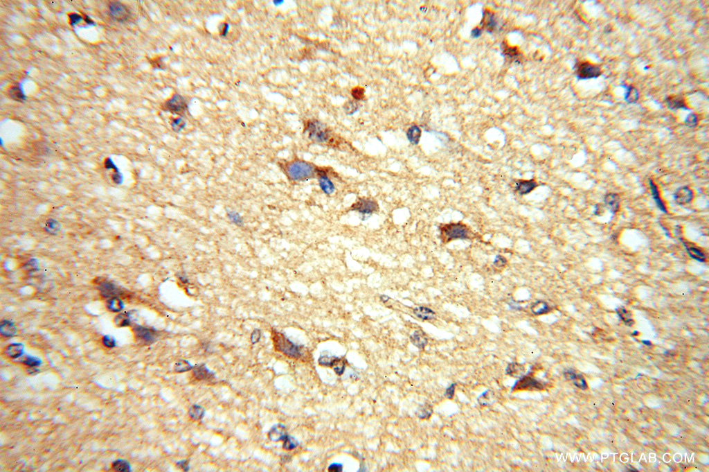 ADO Polyclonal antibody