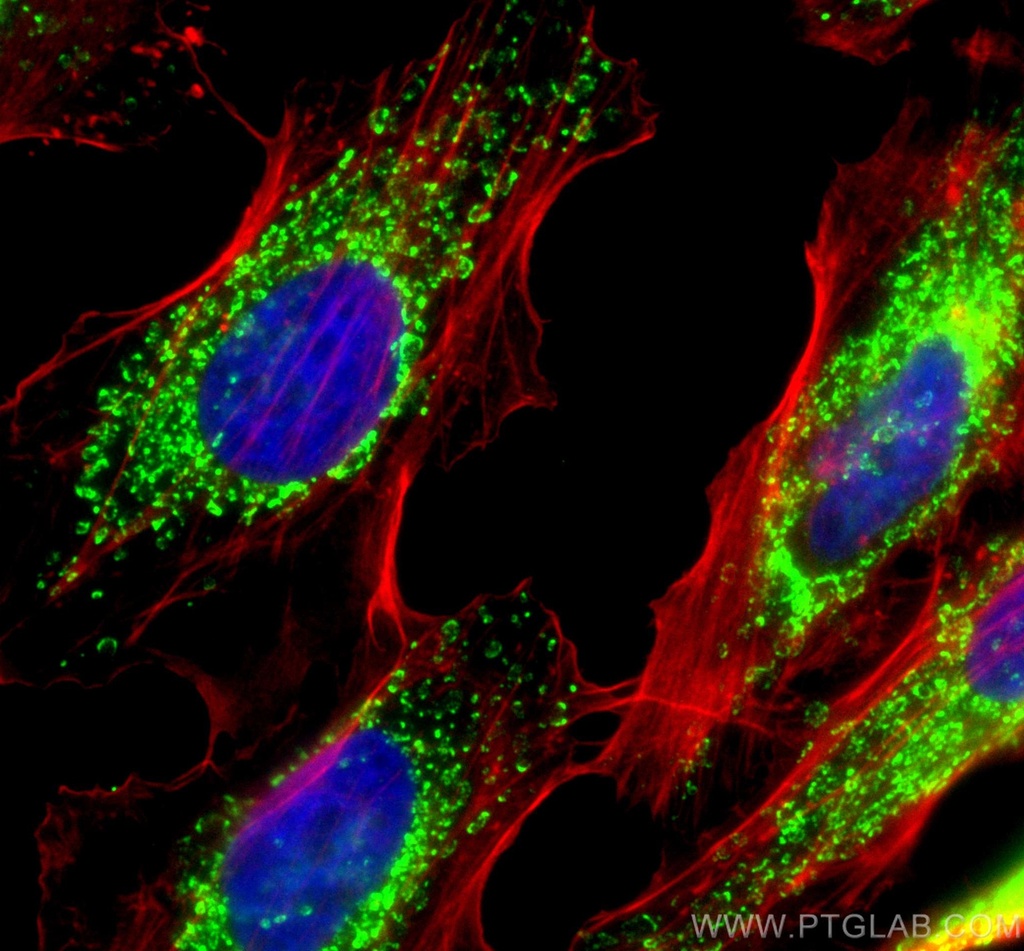 ATP5I Polyclonal antibody