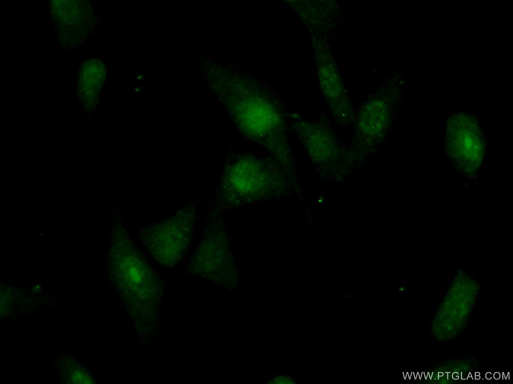 RBM28 Polyclonal antibody