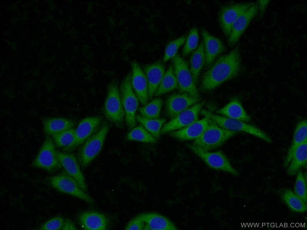 ARH3 Polyclonal antibody
