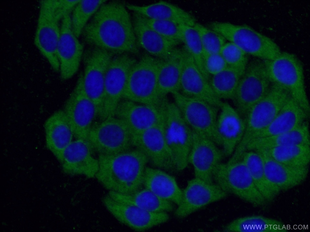 CXXC5 Polyclonal antibody