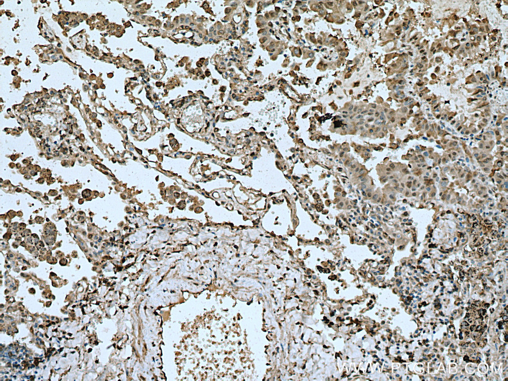 METTL6 Polyclonal antibody
