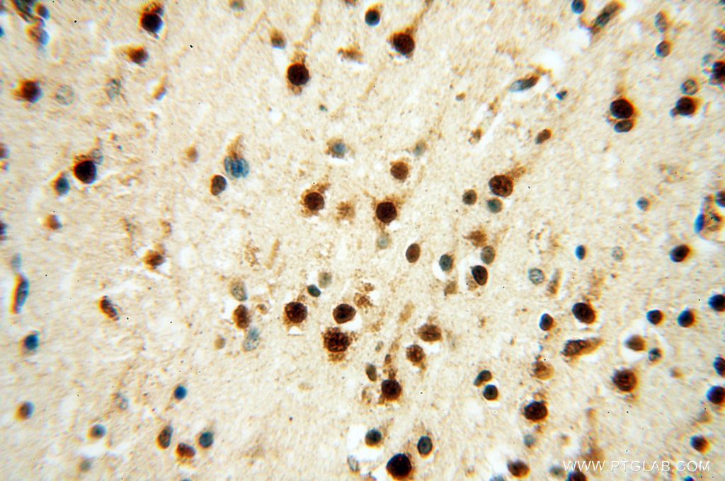 LARP4 Polyclonal antibody