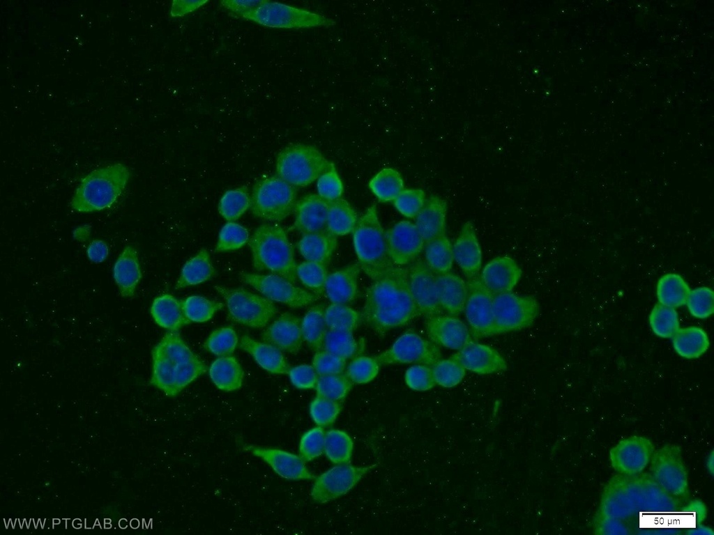 CCKBR-specific Polyclonal antibody
