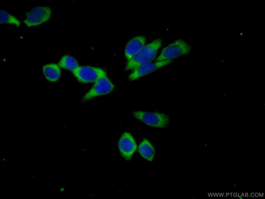 ACPP Polyclonal antibody