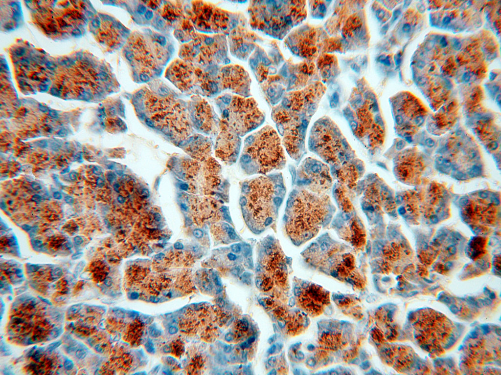 Amylase Alpha Polyclonal antibody