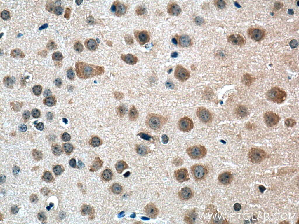 Centrin 2 Polyclonal antibody
