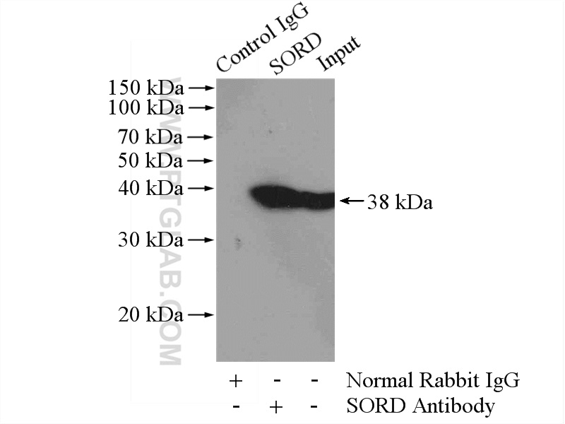 Sorbitol dehydrogenase Polyclonal antibody