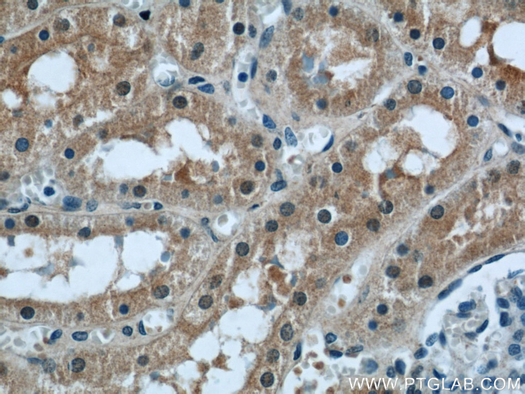 PPP2R1A Polyclonal antibody