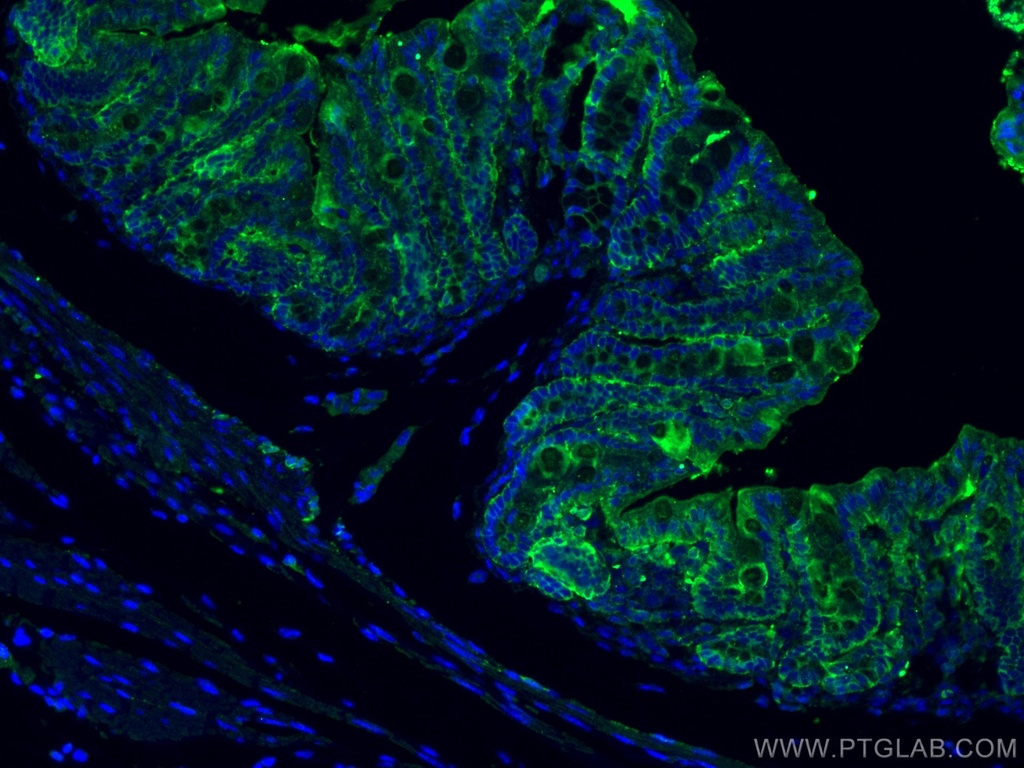 ALDH1A1 Polyclonal antibody
