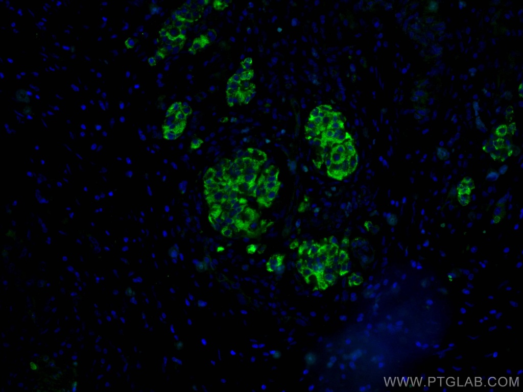 RHEB Polyclonal antibody