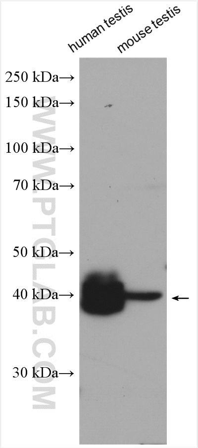 ART3 Polyclonal antibody