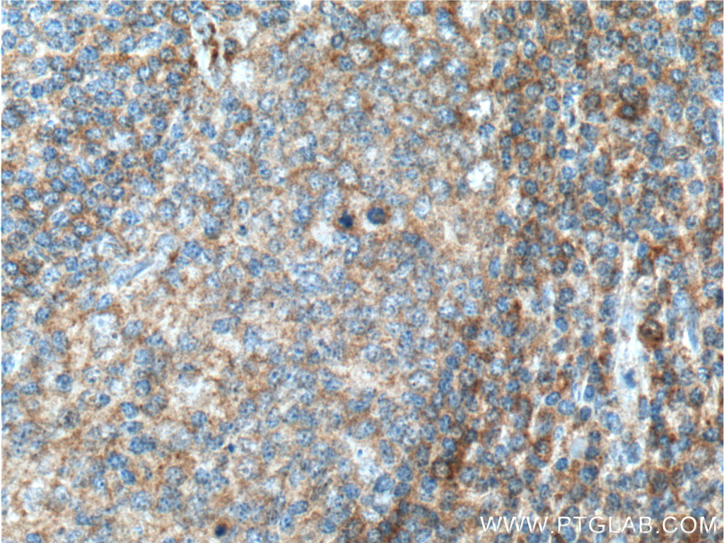ValRS Polyclonal antibody