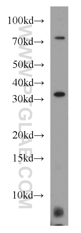 MED4 Polyclonal antibody