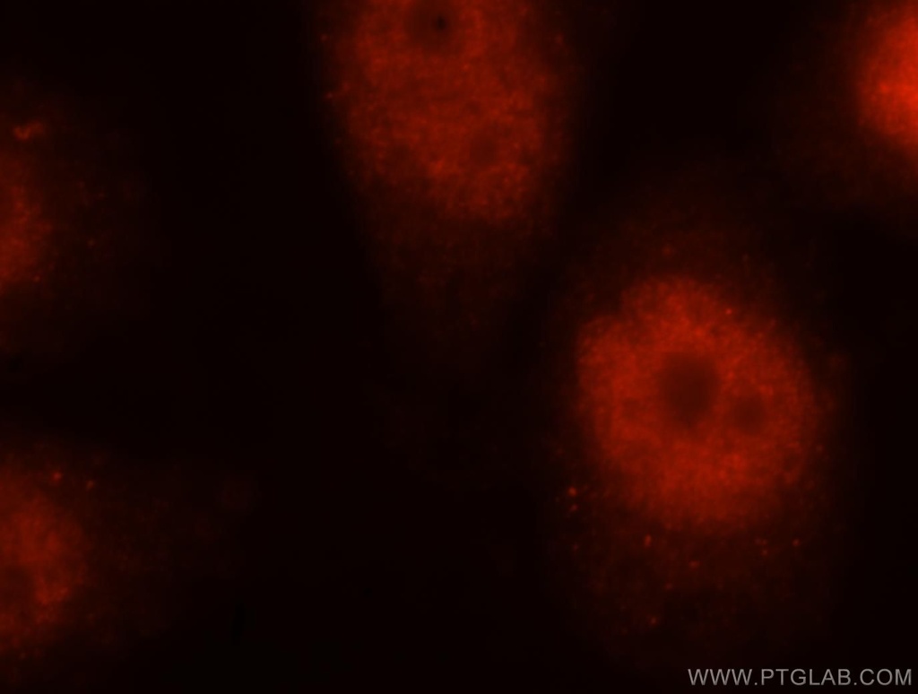 DBR1 Polyclonal antibody