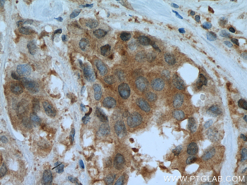PFDN4 Polyclonal antibody