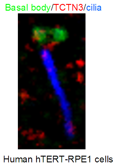 TCTN3 Polyclonal antibody