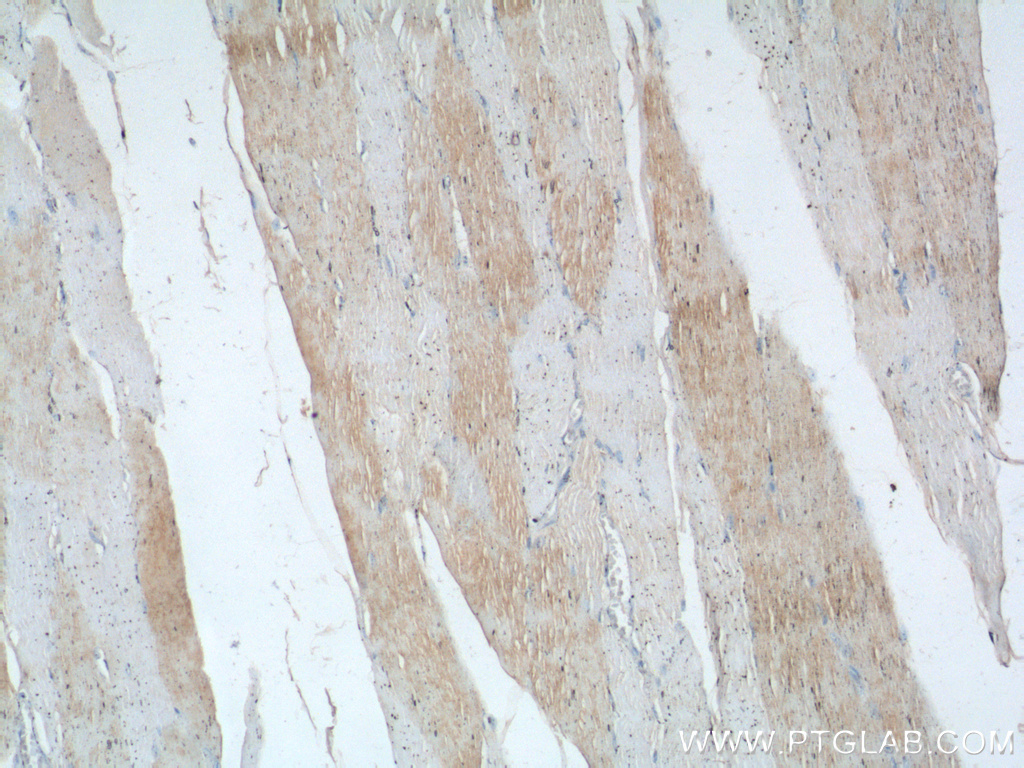 TNNI1 Polyclonal antibody