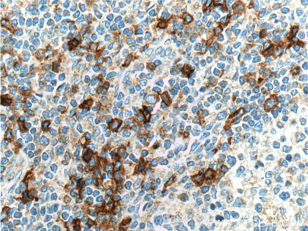 CCR2b-specific Polyclonal antibody