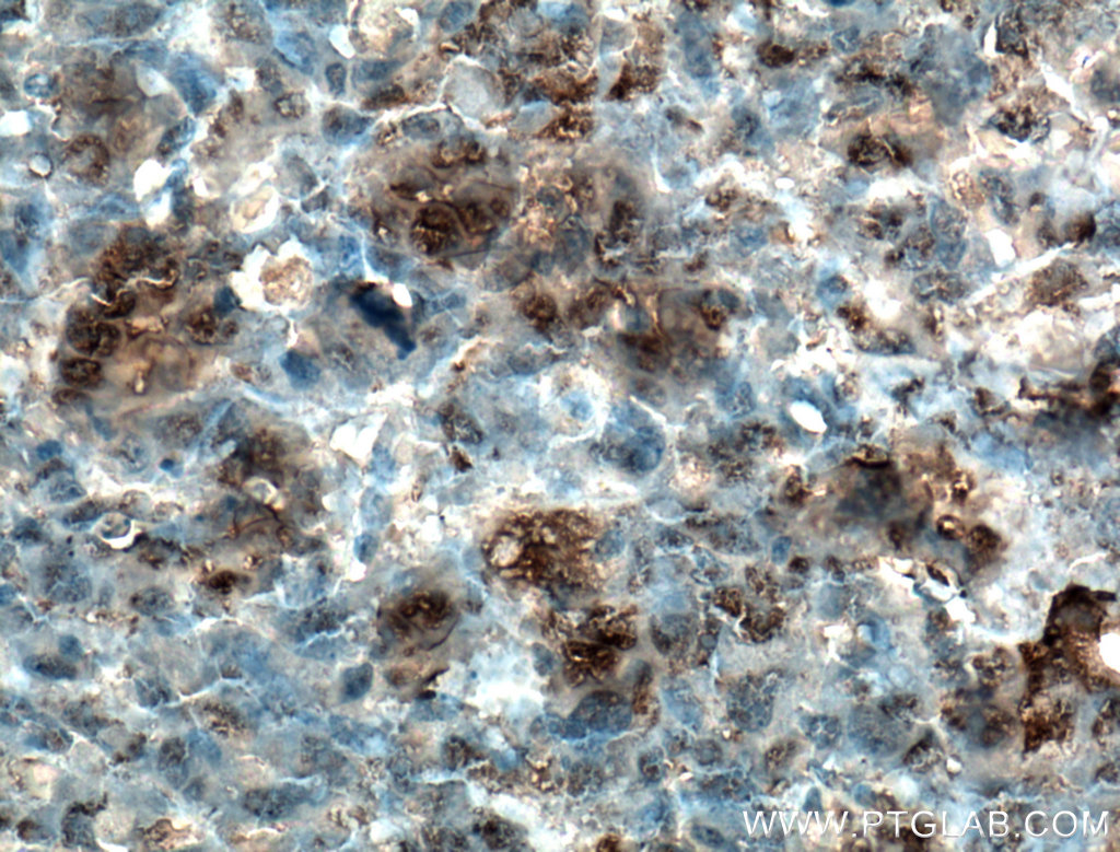 Osteocalcin Polyclonal antibody