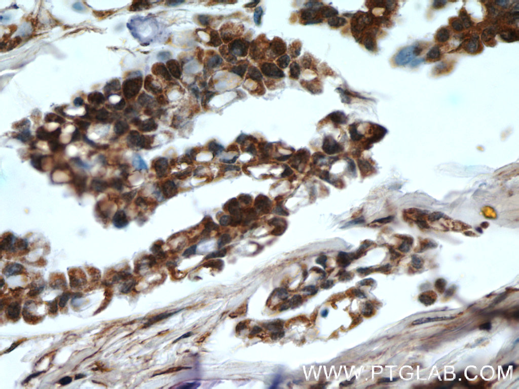 HDAC4-specific Polyclonal antibody