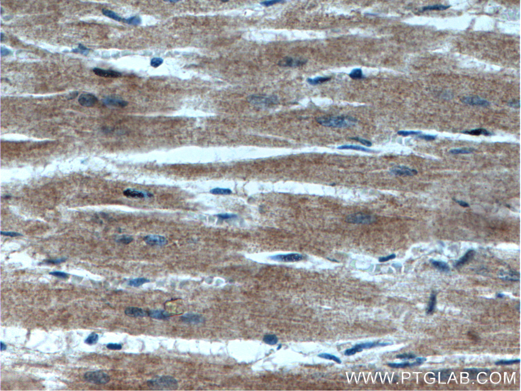 VPS39 Polyclonal antibody