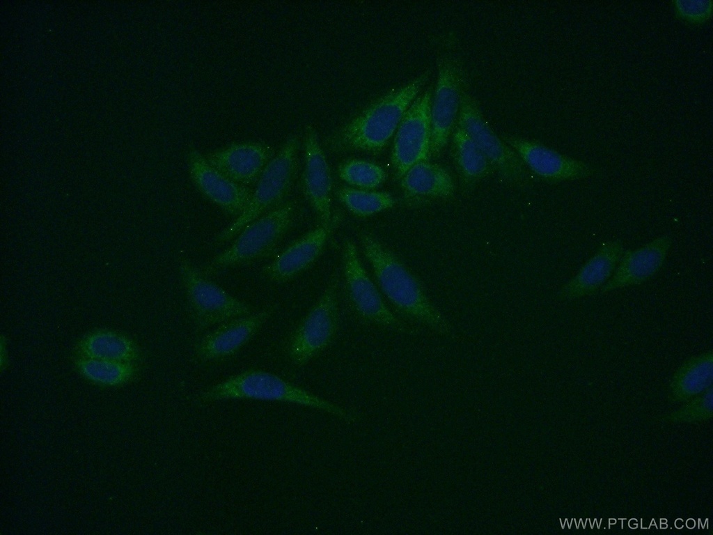 SDSL Polyclonal antibody