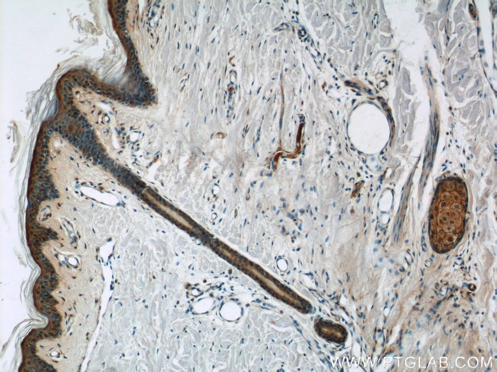 DMKN Polyclonal antibody