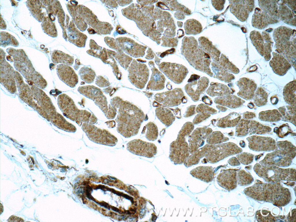 MYL12A Polyclonal antibody