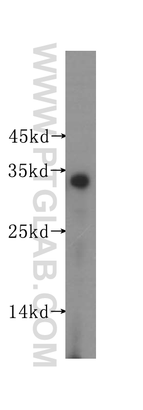 SULT2A1 Polyclonal antibody